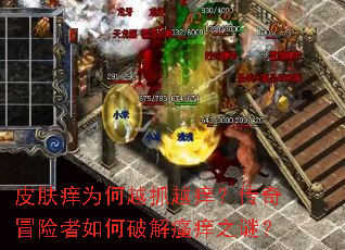 皮肤痒为何越抓越痒?传奇冒险者如何破解瘙痒之谜? 皮肤痒为何越抓越痒?传奇冒险者如何破解瘙痒之谜?